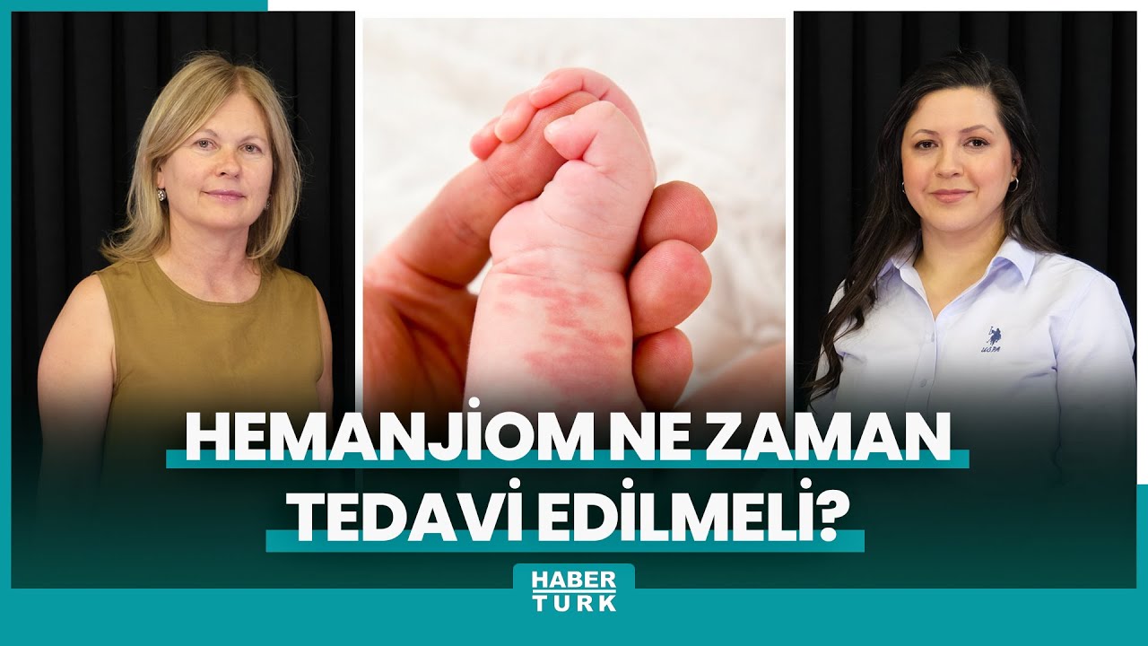 Hemanjiom ne zaman tedavi edilmeli?
