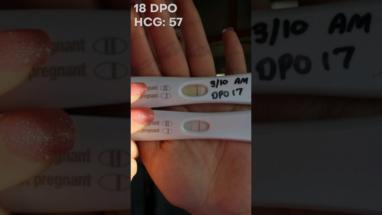 Pregnancy Test Progression with Ectopic (First Response) #infertility #ostomy | Let's Talk IBD