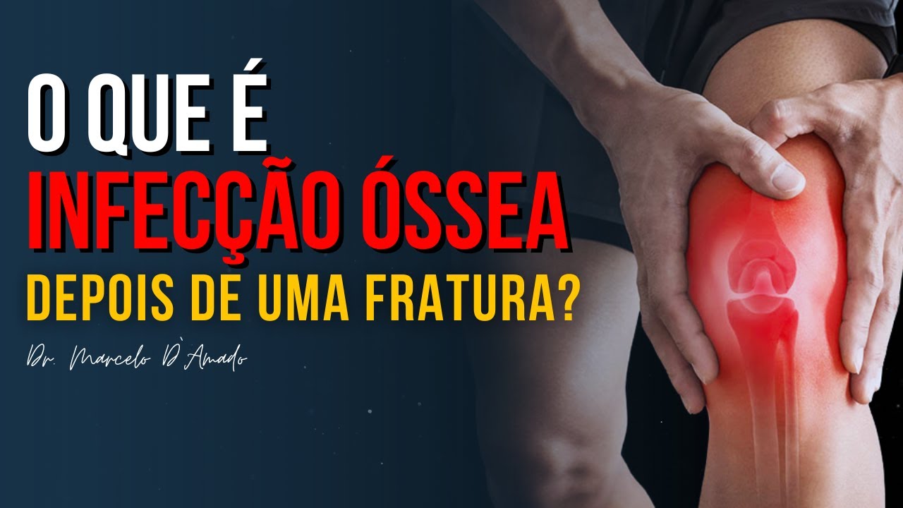 OSTEOMIELITE | O QUE É INFECÇÃO ÓSSEA DEPOIS DE UMA FRATURA?