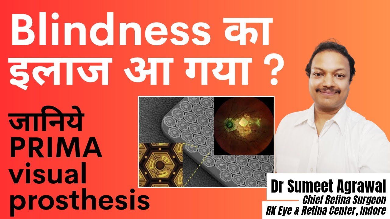 BLINDNESS का इलाज आ गया !?! क्या है PRIMA VISUAL PROSTHESIS ?