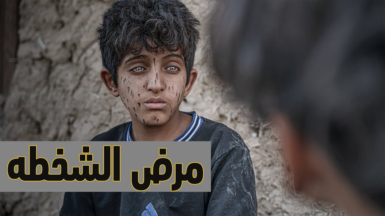 الفلم العراقي مرض الشخطه