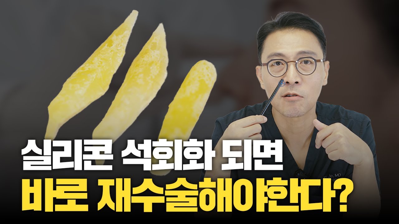 284화. 코성형수술 후 실리콘이 석회화 되면 위험한 건가?