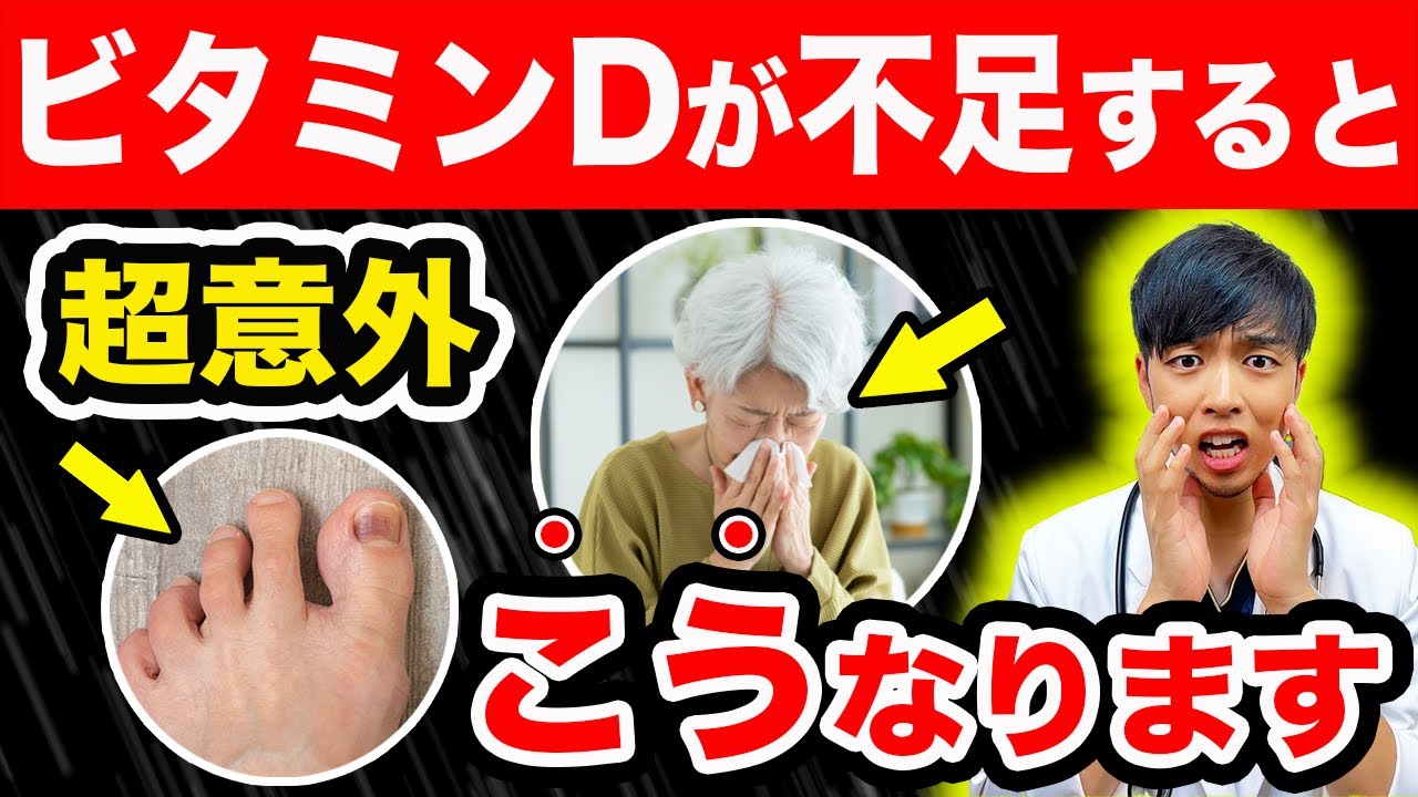 【医師解説】こんな人は『ビタミンD不足』です…【がんリスク/免疫力/血糖/うつ病】知らないと後悔します…