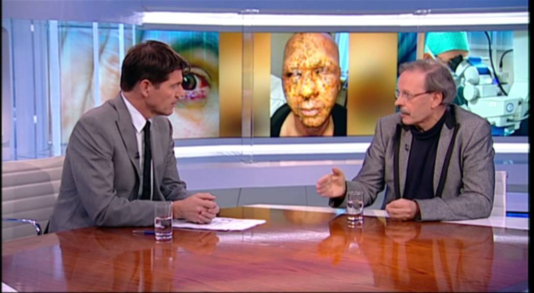 Reportage Nieuwsuur over vuurwerkslachtoffers in Het Oogziekenhuis Rotterdam 2/2/2015