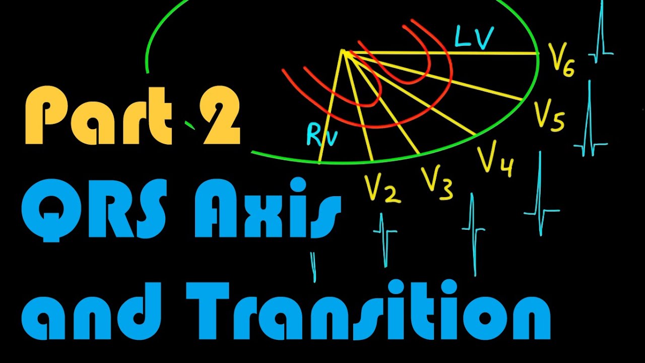 QRS Axis, QRS Transition, and R-Wave Progression, Part 2: How to Read an EKG Curriculum