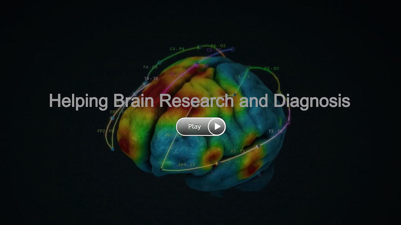 Swiss Brain Data Bank announcement | Jamil El-Imad |45th Swiss Telecommunication Summit