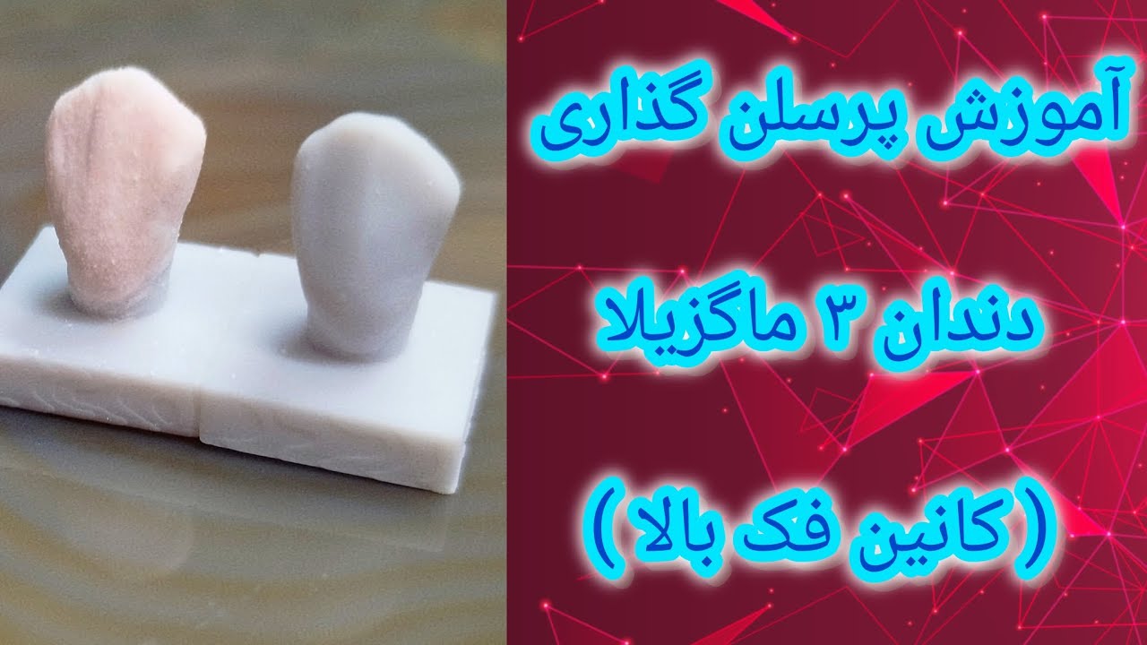 🔥آموزش مرحله به مرحله پرسلن گذاری دندان ۳ فک بالا| Porcelain build up canin 3 maxilla🎯🦷🎨🖌️👩🏼‍🔬👩🏼‍⚕️