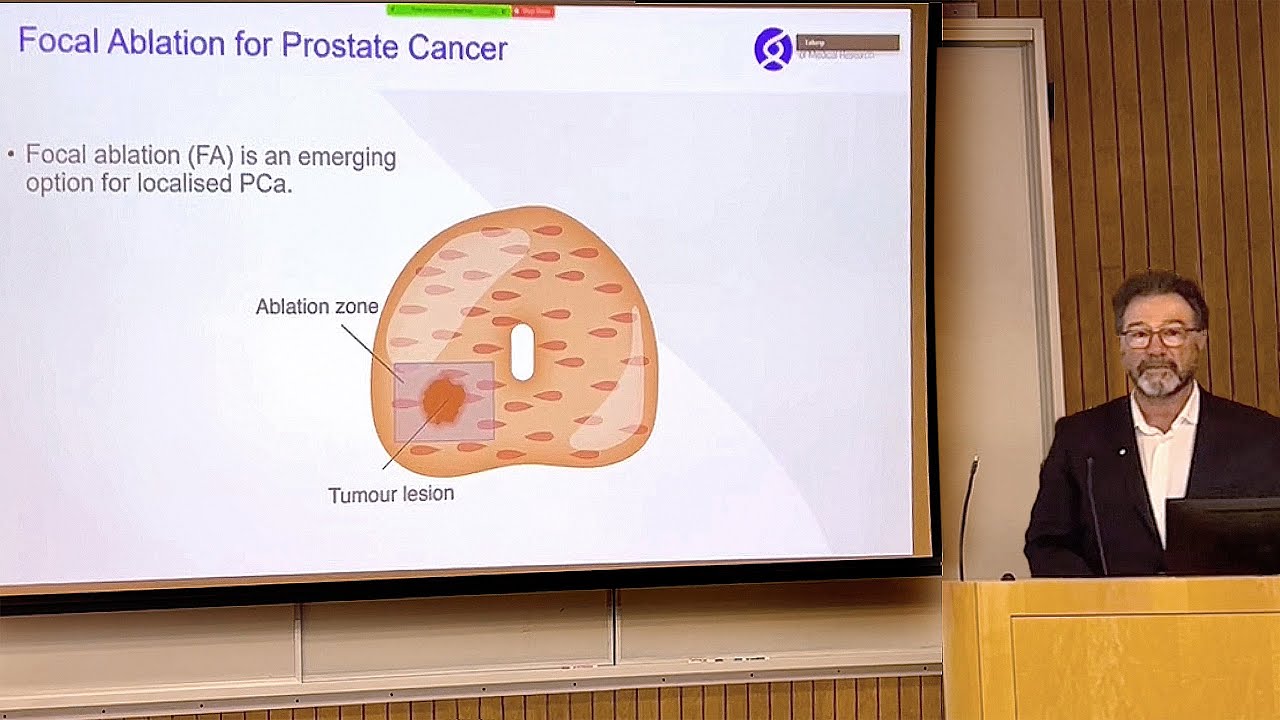 Focal Therapies for Prostate Cancer and NanoKnife© IRE - UCLA Presentation