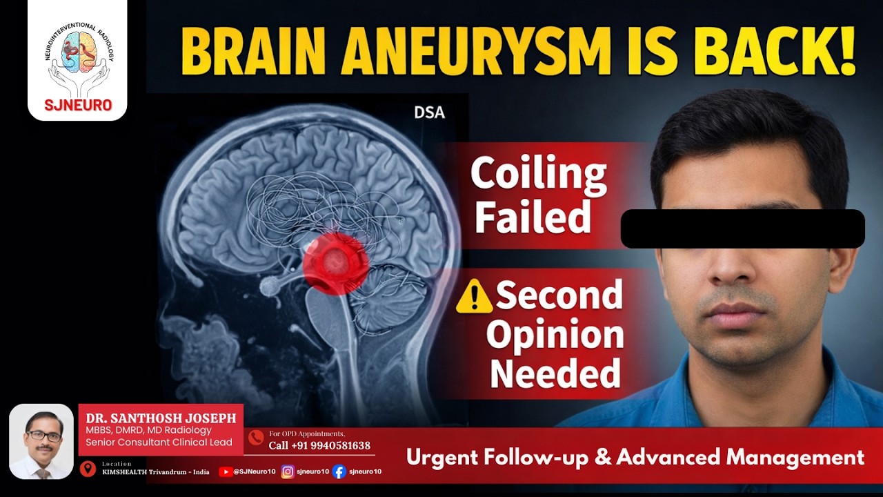 Brain Aneurysm Is Back! | ACOM Aneurysm Regrowth After Coiling