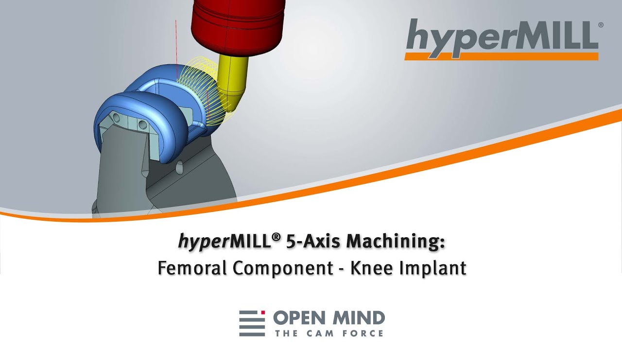 hyperMILL 5-Axis Machining: Femoral Component – Knee Implant | CAM-Software