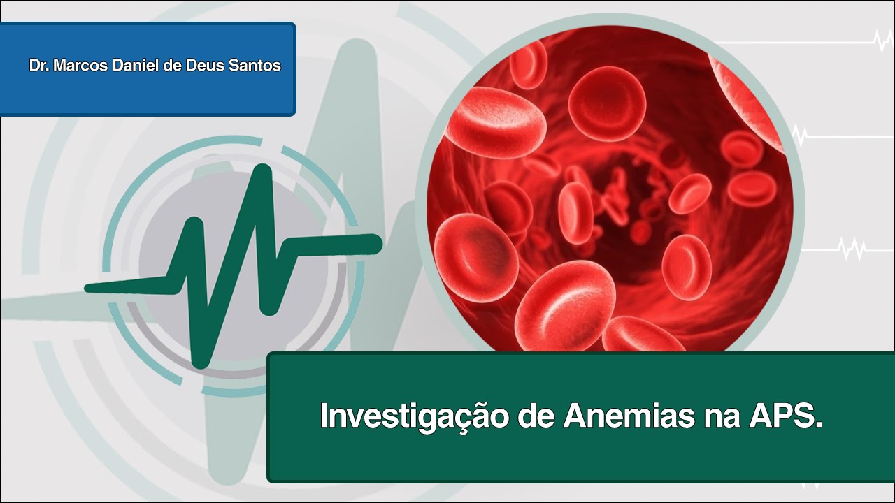 Webconferência:Investigação de Anemias na APS - Telessaúde ES 02/06/2015