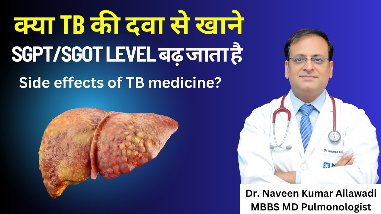 क्या TB की दवा से खाने SGPT/SGOT Level बढ़ जाता है | Side effects of TB medicine? |   8586805004