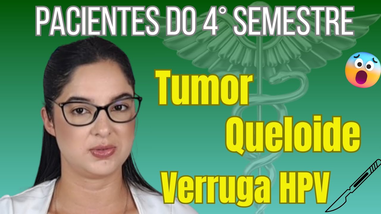 PEGAMOS PACIENTE NO AMBULATÓRIO COM VERRUGA HPV ‼️          |ALICE NETTO |