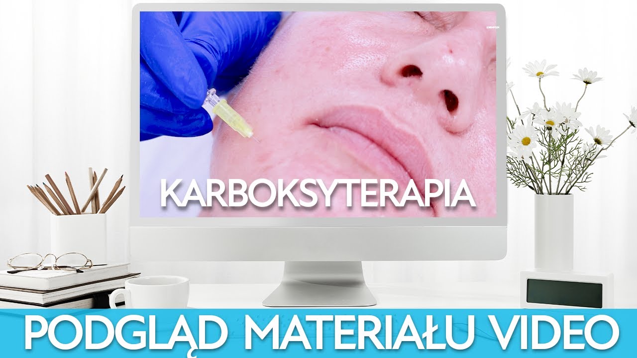 Na czym polega KARBOKSYTERAPIA?