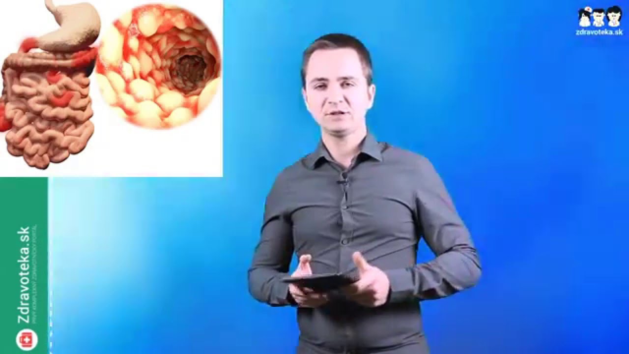 Crohnova choroba