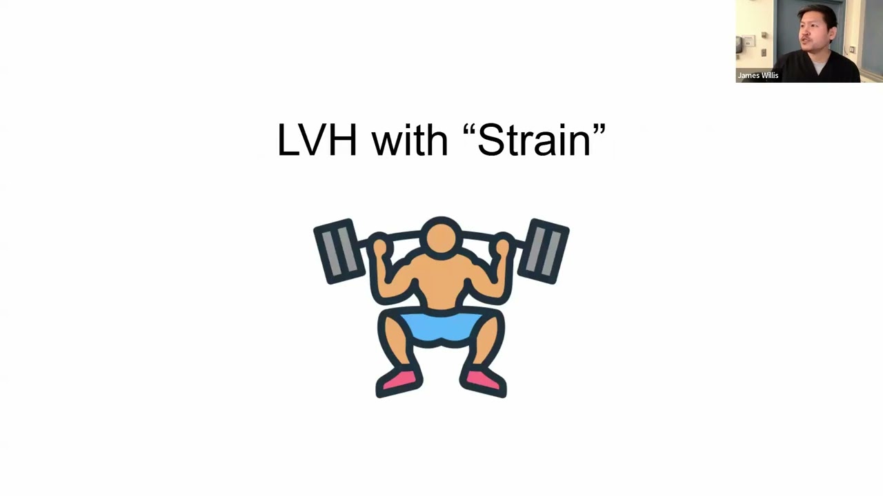Dr. Tang - LVH ECG