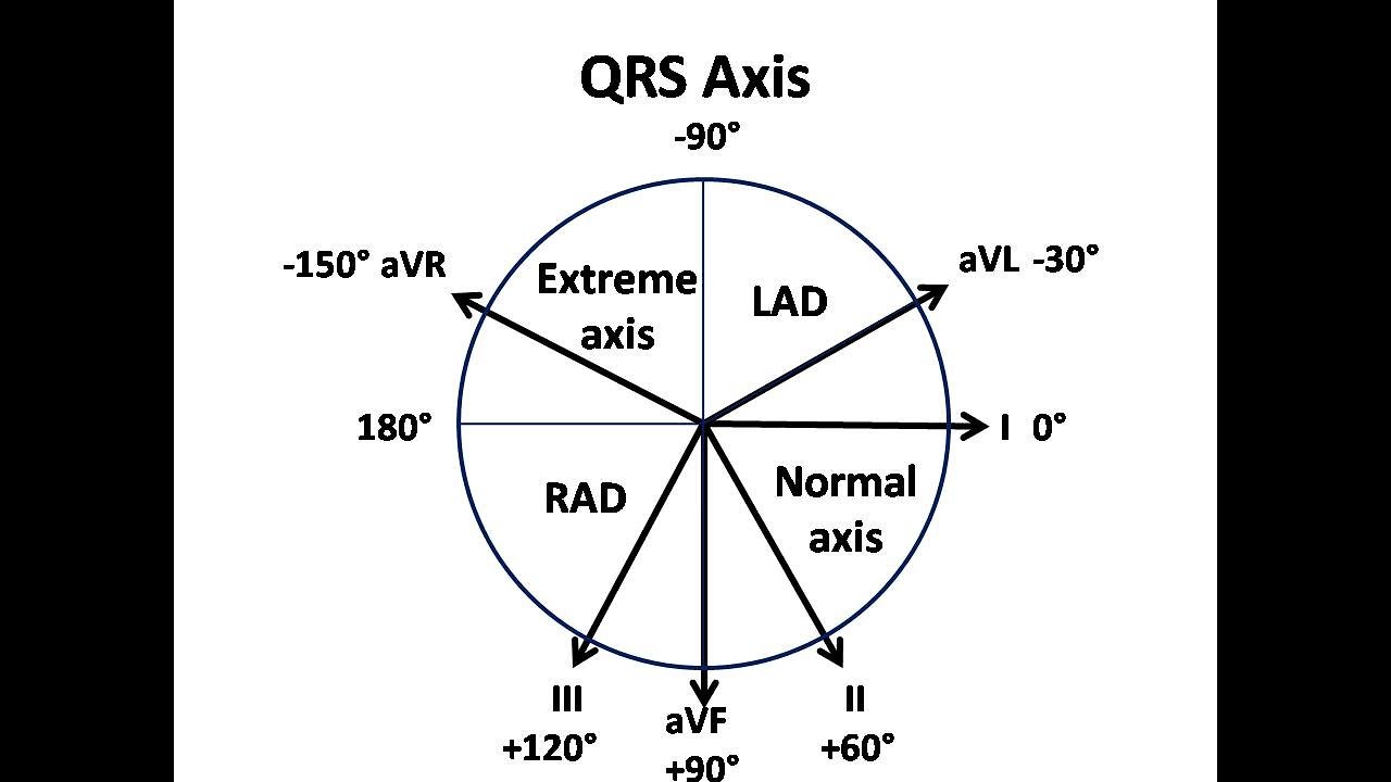 CardioMinds: ECG axis