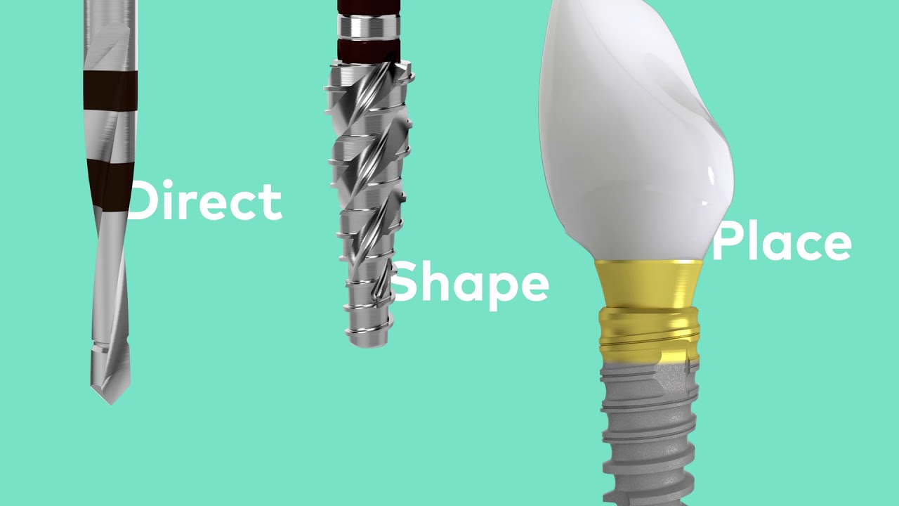 Nobel Biocare N1&trade; in 100 seconds