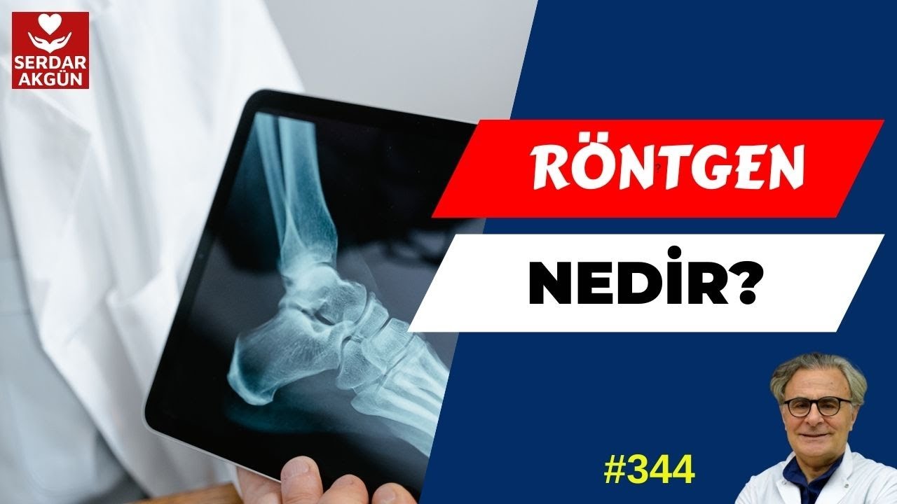 344. Röntgen Işınlarının Keşfi ve Kanser Tedavisindeki Rolü Nedir