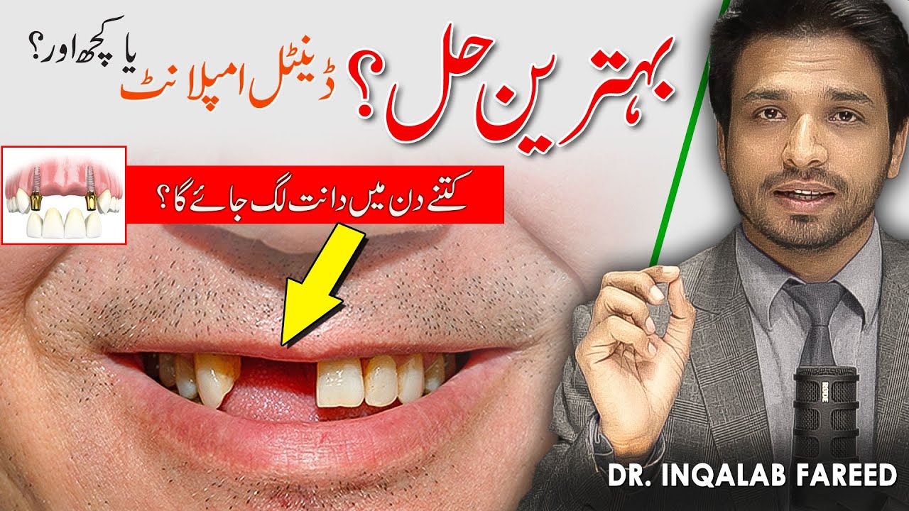 Best Treatment for Missing Front Teeth | @Dr. Inqalab Fareed