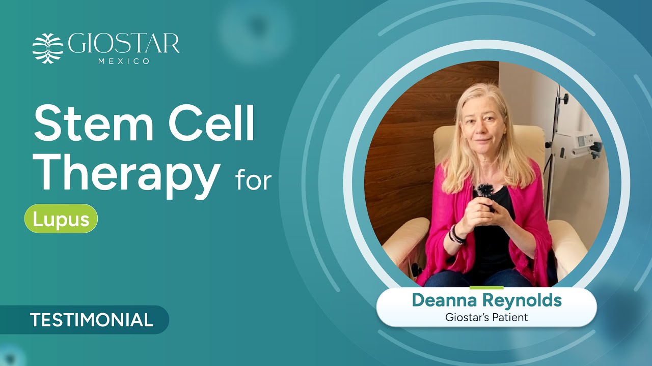 Stem Cell Therapy for Lupus: Patient Experience #giostarmexico