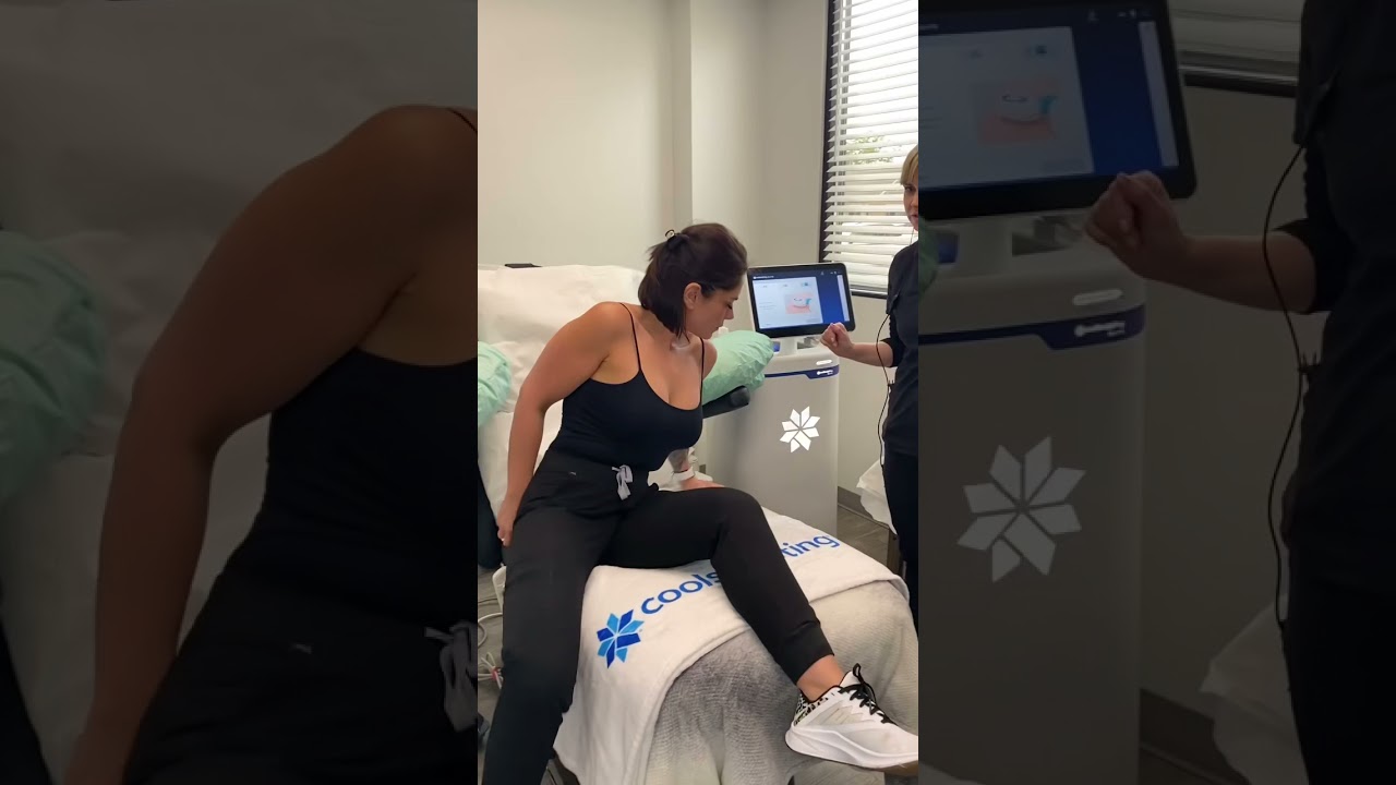 Coolsculpting the stubborn upper arm fat away ❄️