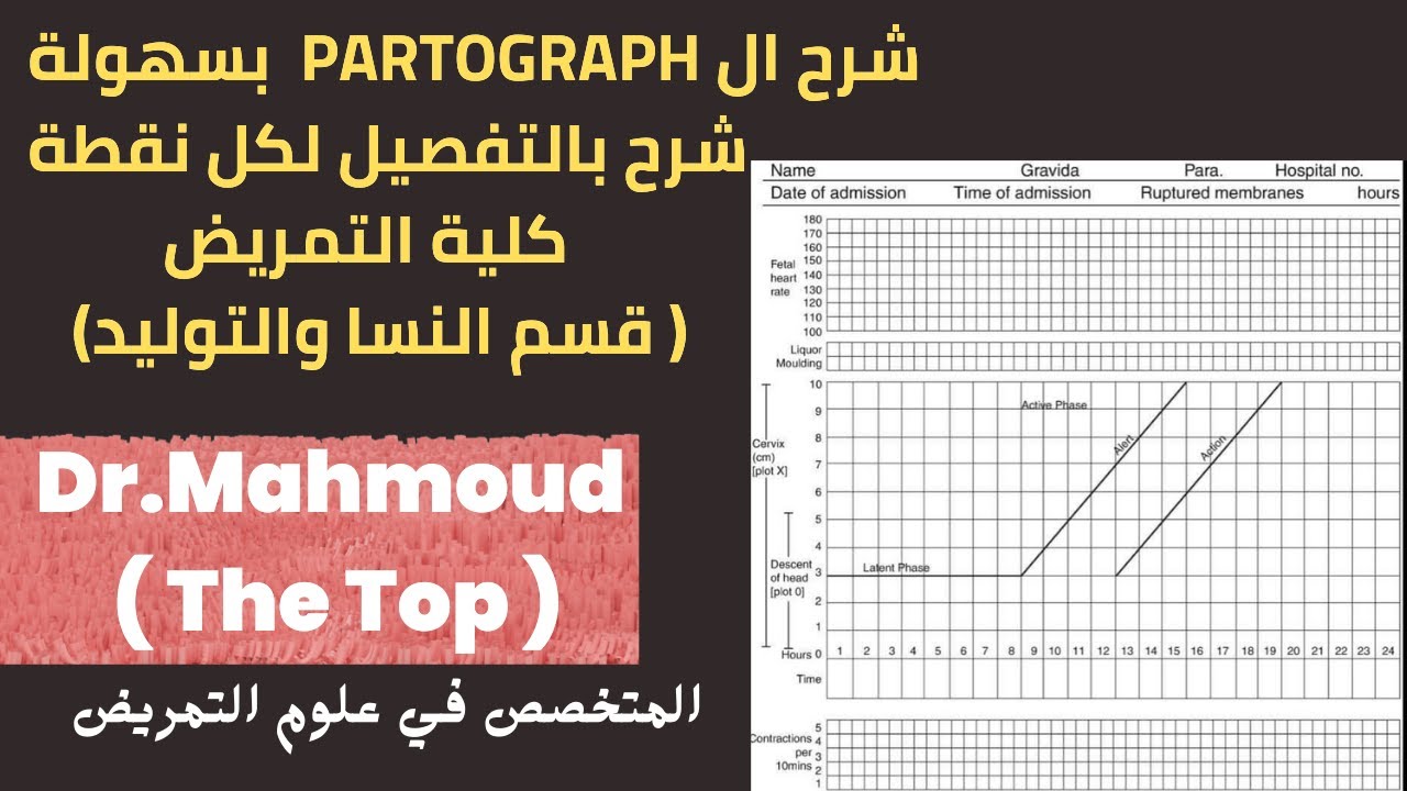 شرح partograph بالعربي - شرح partogram بسهولة جدا - شرح البارتوجراف بالعربي - للدكتور محمود