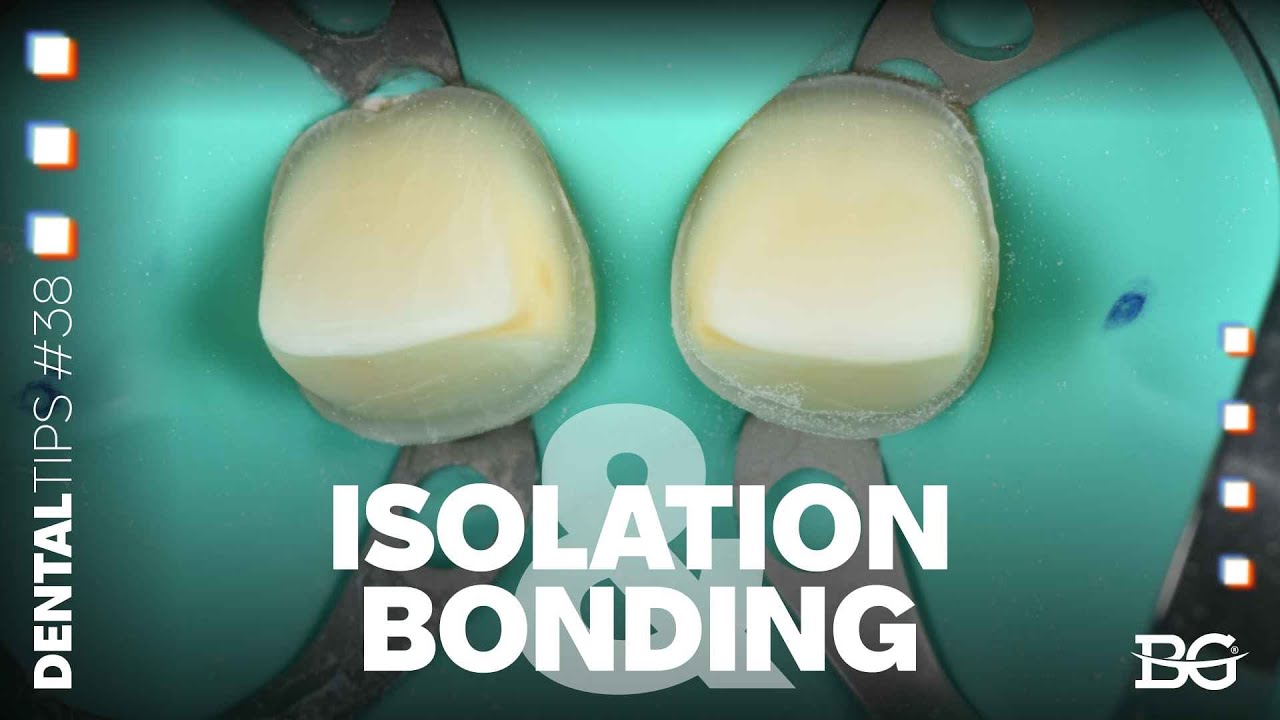 Optimal anterior isolation & bonding
