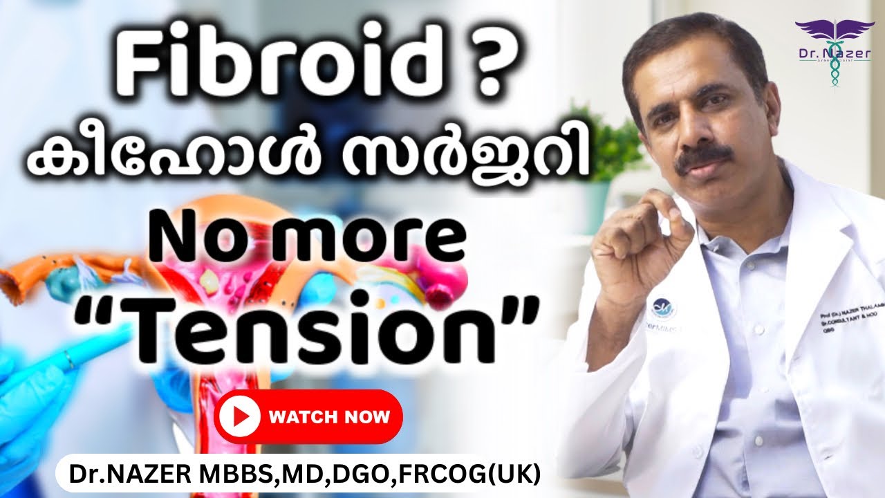 FIBROID TREATMENT | KEYHOLE SURGERY | Malayalam | ഗര്‍ഭാശയ മുഴ | Dr Nazer