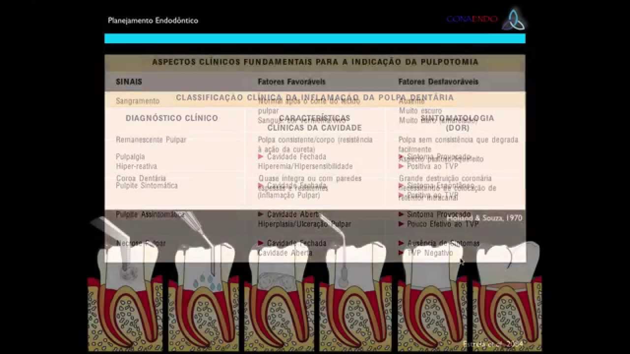 Planejamento do Diagnóstico e Tratamento Endodôntico