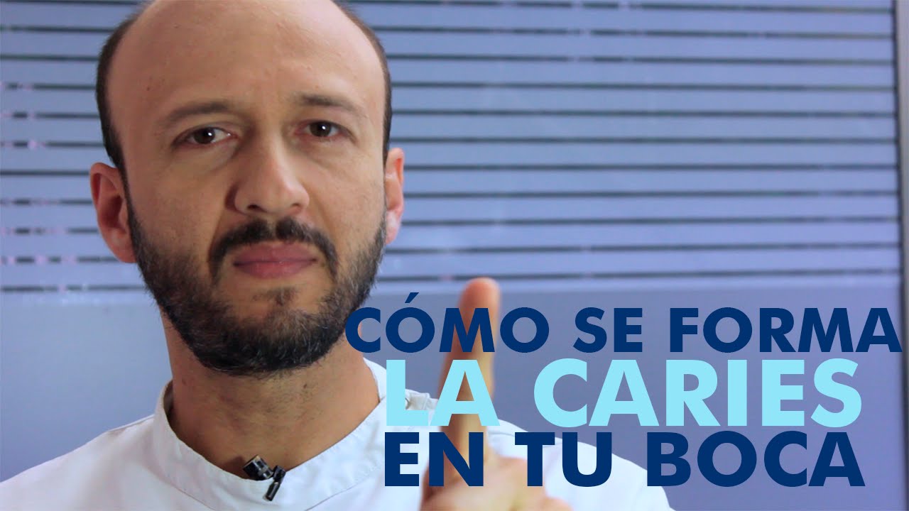 3. Cómo Se forma la Caries y la enfermedad periodontal - Doctor Tascón
