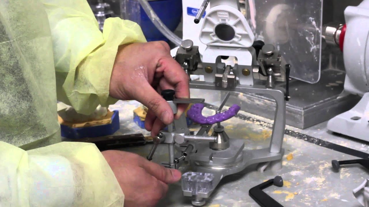 facebow mounting