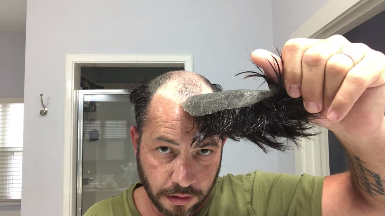 How to Remove Your Hair System or Hair Replacement The Right Way