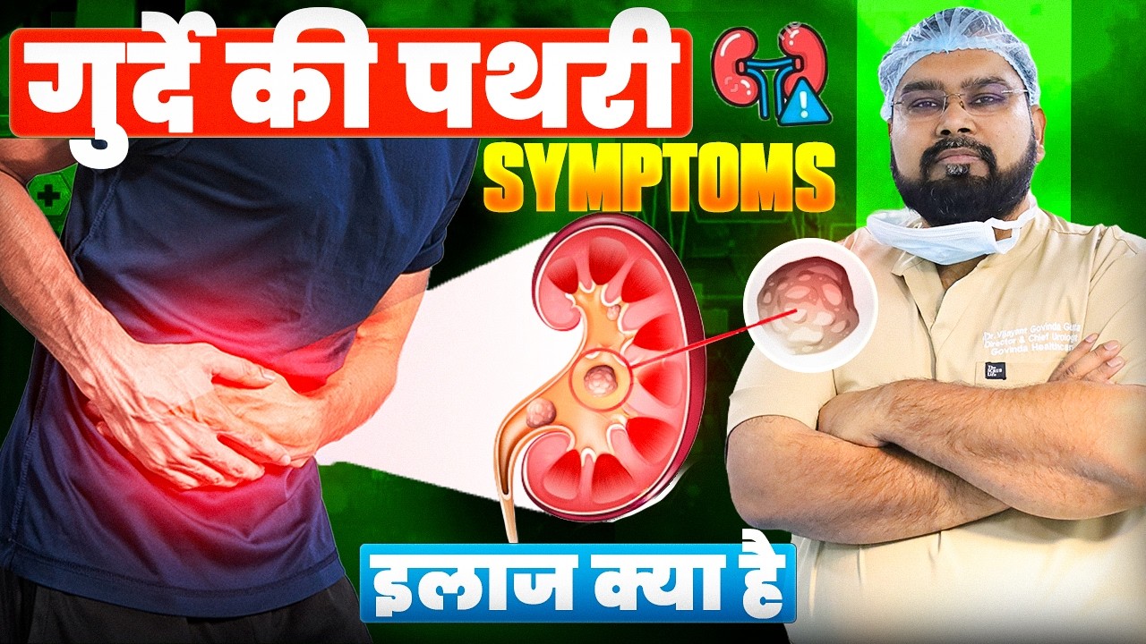 Garmi में Kidney Stone से कैसे बचें? | पथरी निकालने की दवा और RIRS Laser Surgery का सच