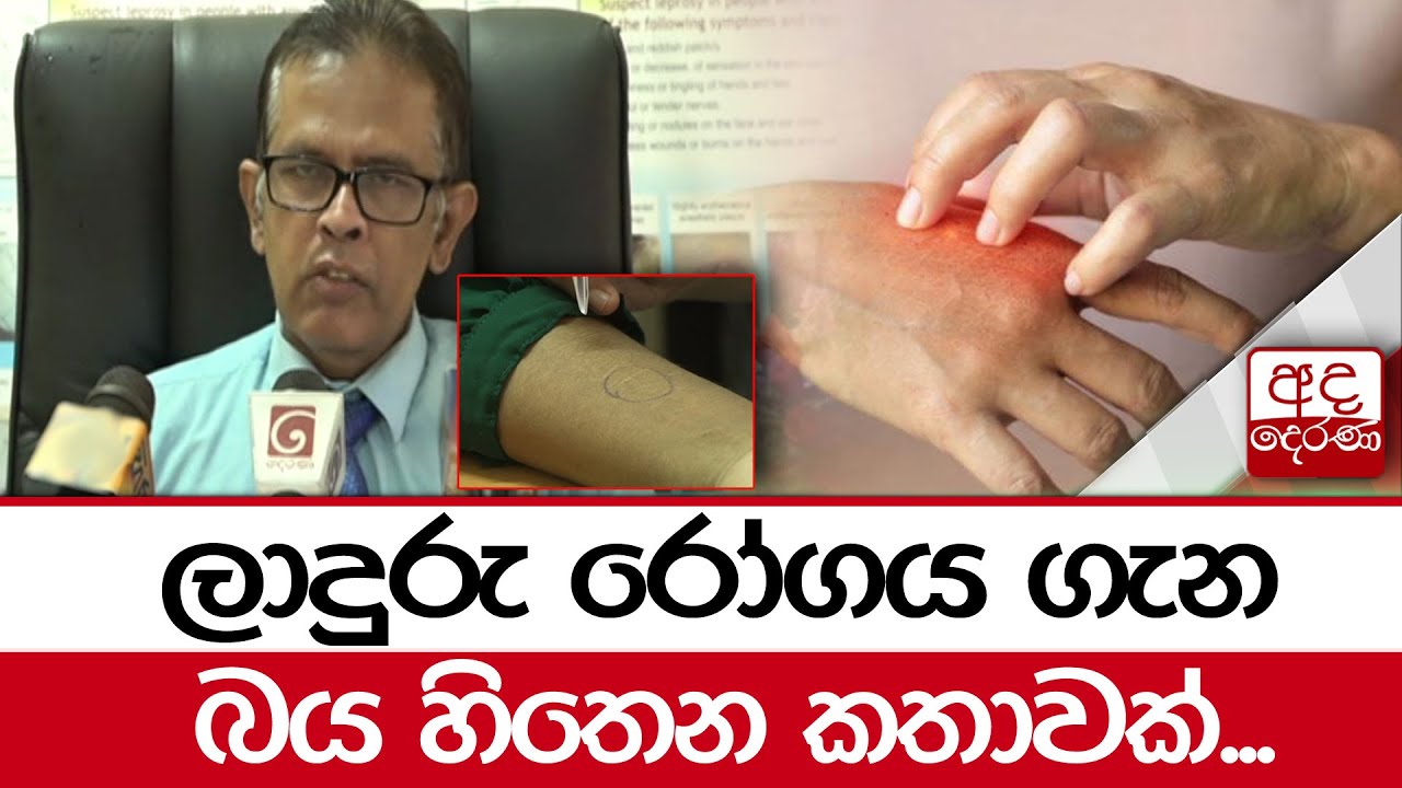 ලාදුරු රෝගය ගැන බය හිතෙන කතාවක්...