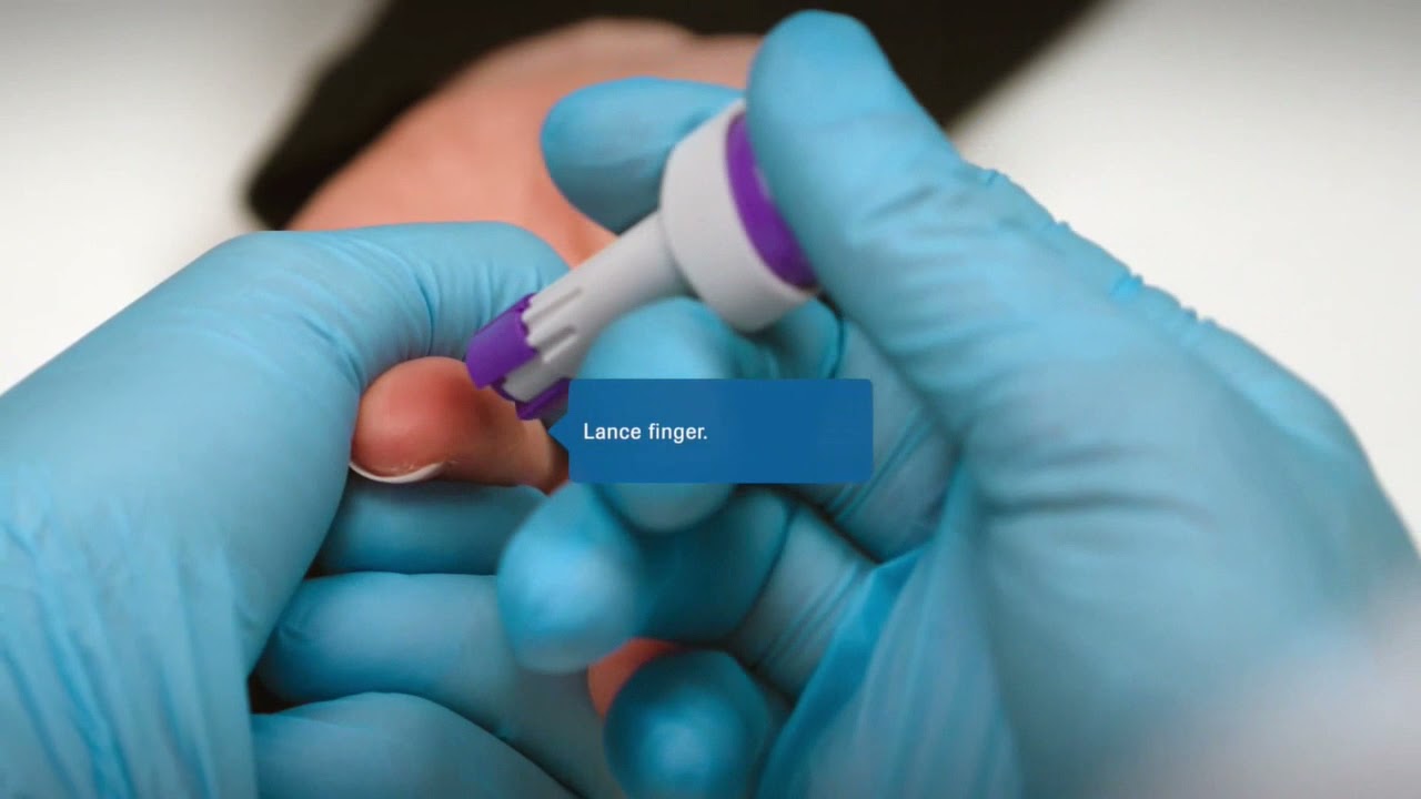 cobas b 101 Training Video   HbA1c in % test