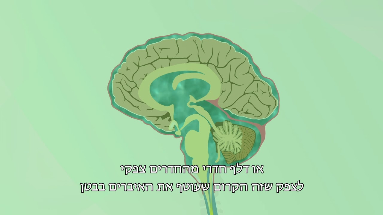 הידרוצפלוס - Hydrocephalus