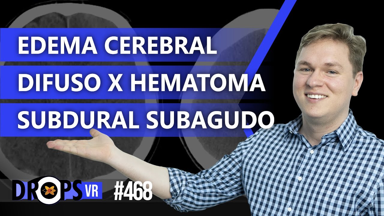 EDEMA CEREBRAL DIFUSO x HEMATOMA SUBDURAL SUBAGUDO