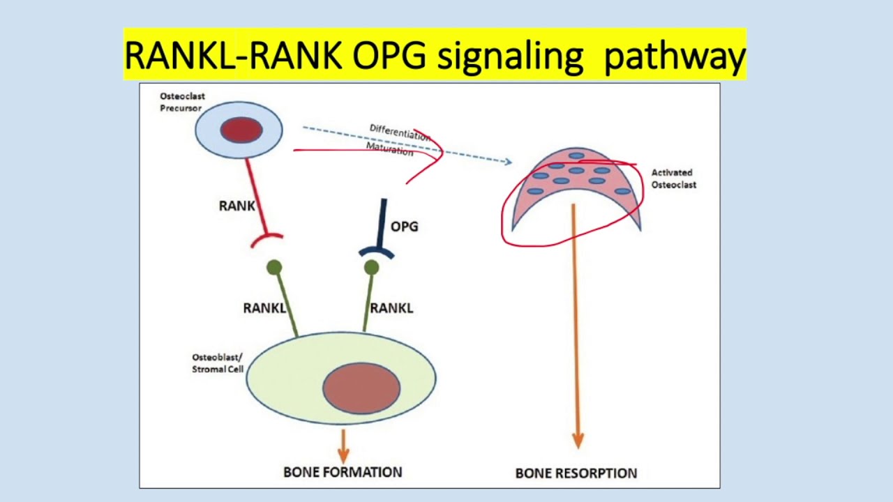 Orthopaedic basic science | Bone cells | RANKL-RANK-OPG pathway |  by Dr.Hemanta Dhungana