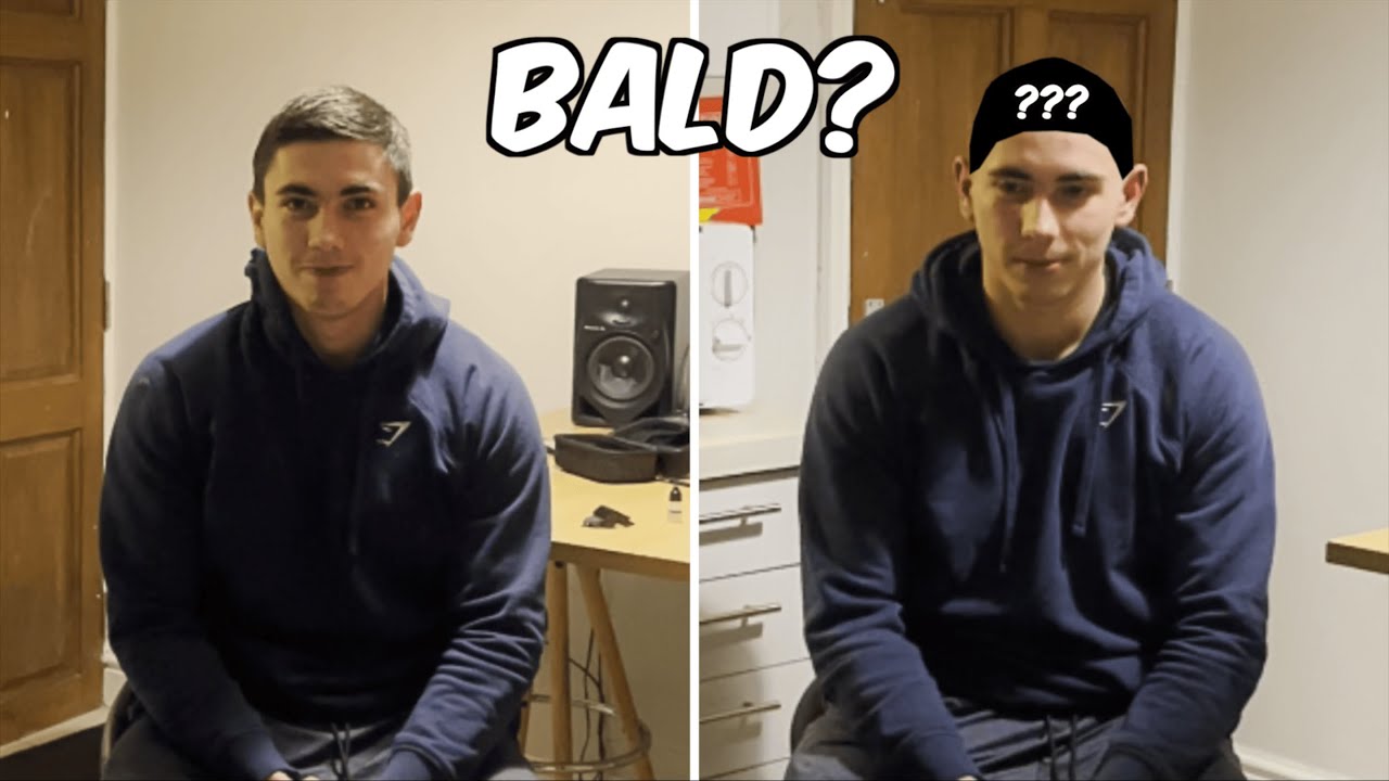Going Bald...