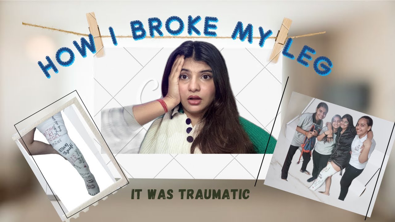 Storytime : How i broke my leg😭🥲|| It was shocking 🫨||