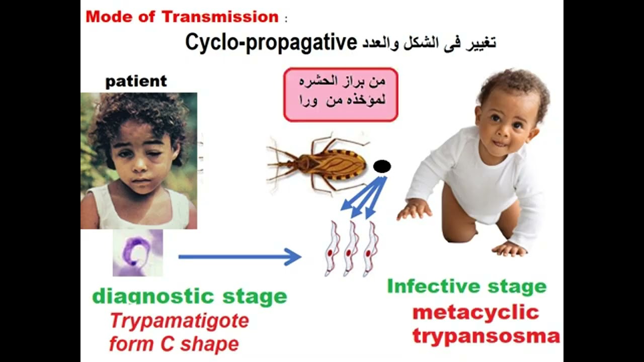 Parasitology Blood module American trypansoma