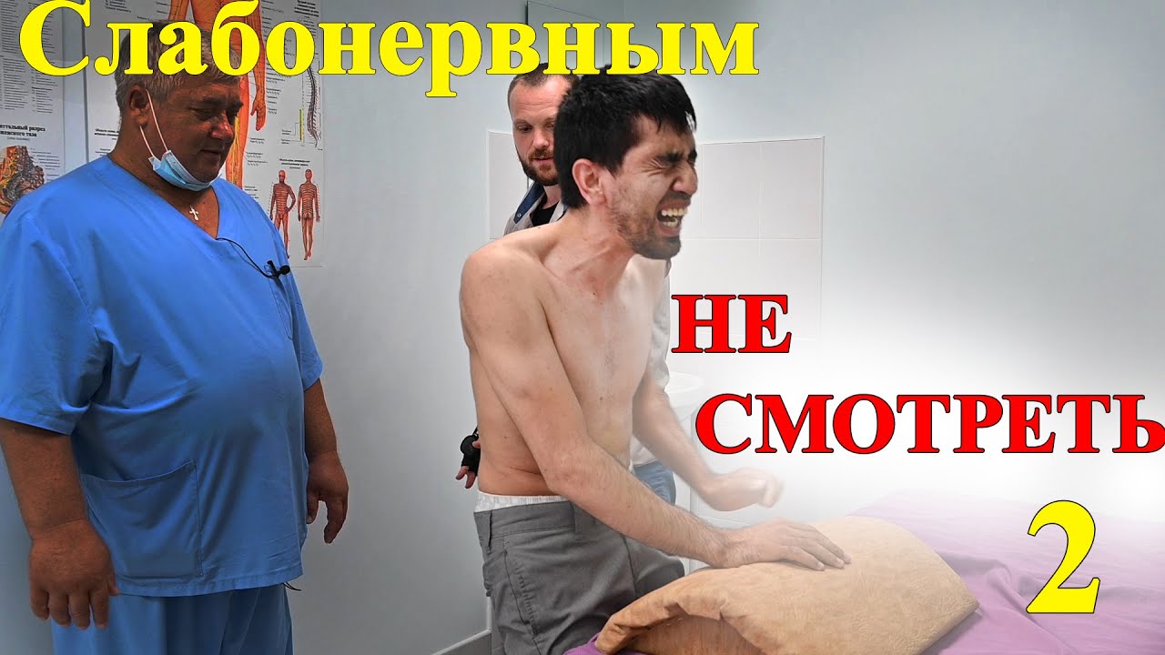 Страшные МУЧЕНИЯ 3 года. Слабонервным НЕ СМОТРЕТЬ часть 2 (Костоправы: Юрий Репин и Антипов Михаил)
