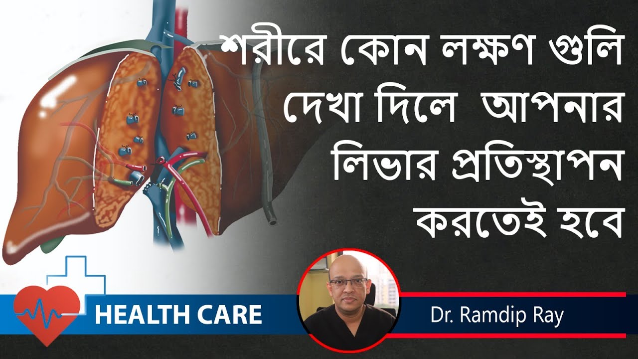 Signs of End-Stage Liver | শরীরে কোন লক্ষণ গুলি হলে লিভার প্রতিস্থাপন জরুরী | Dr. Ramdip Ray