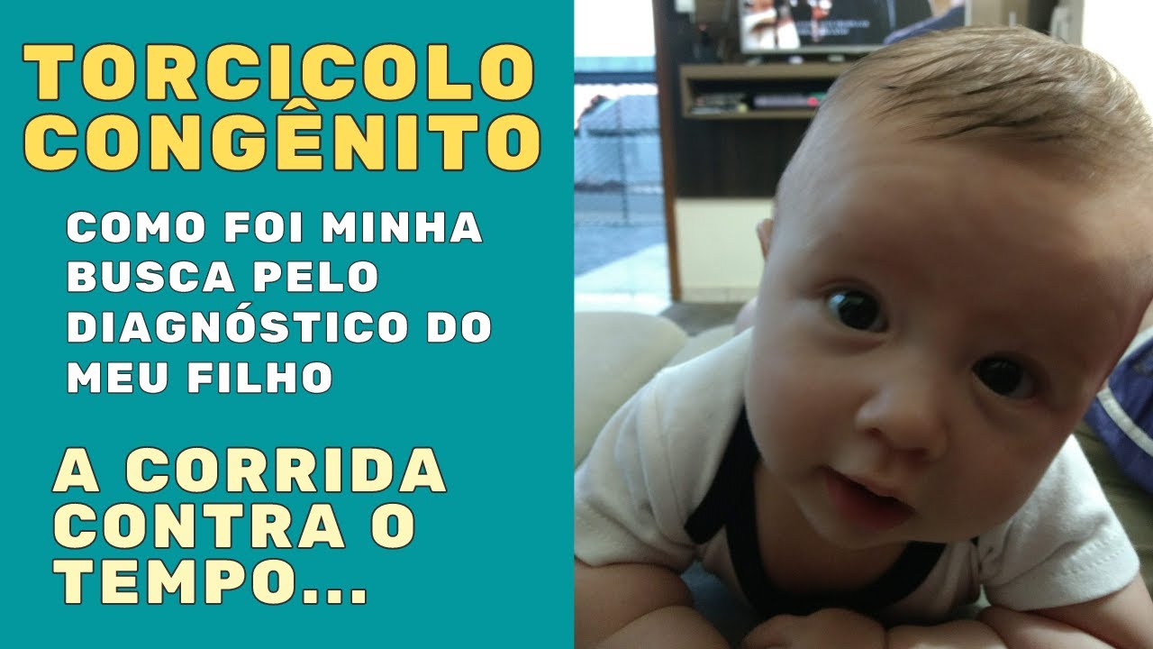 COMO DESCOBRI QUE MEU FILHO TINHA TORCICOLO CONGÊNITO | TORCICOLO CONGÊNITO BEBÊ