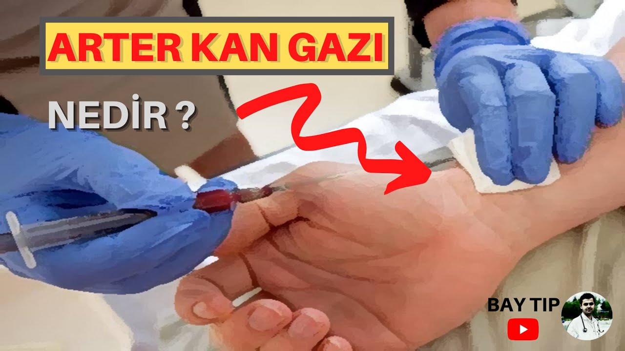 ARTER KAN GAZI NEDİR?