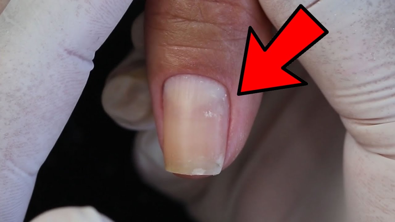 Cutilagem Perfeita do Dedão da mão por Faby Cardoso
