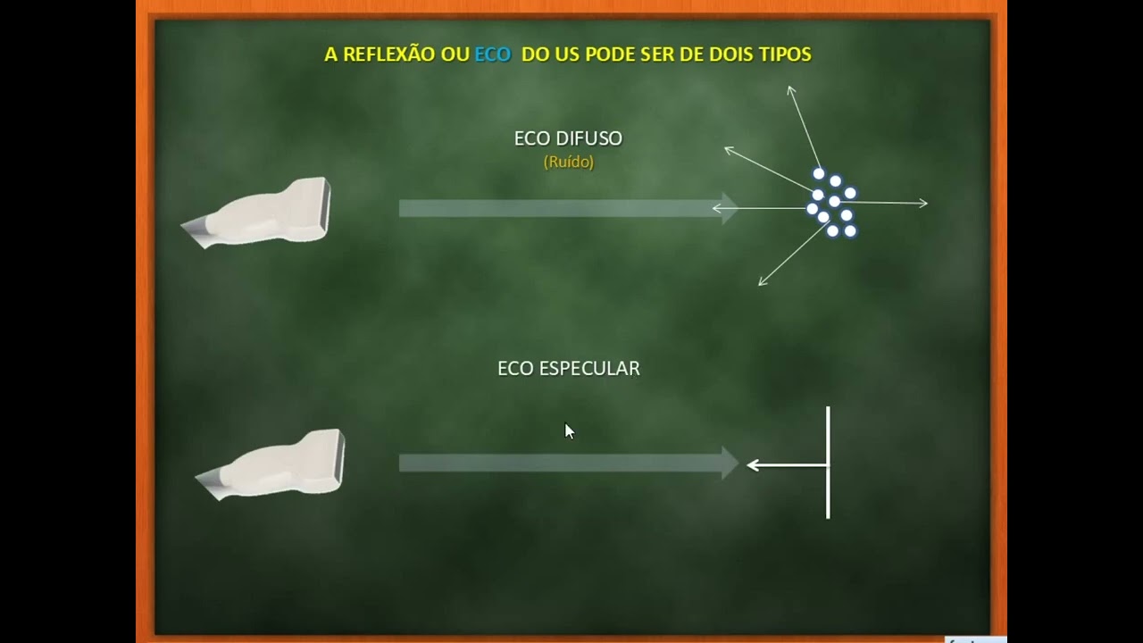 Ultrassonografia  musculoesquelética