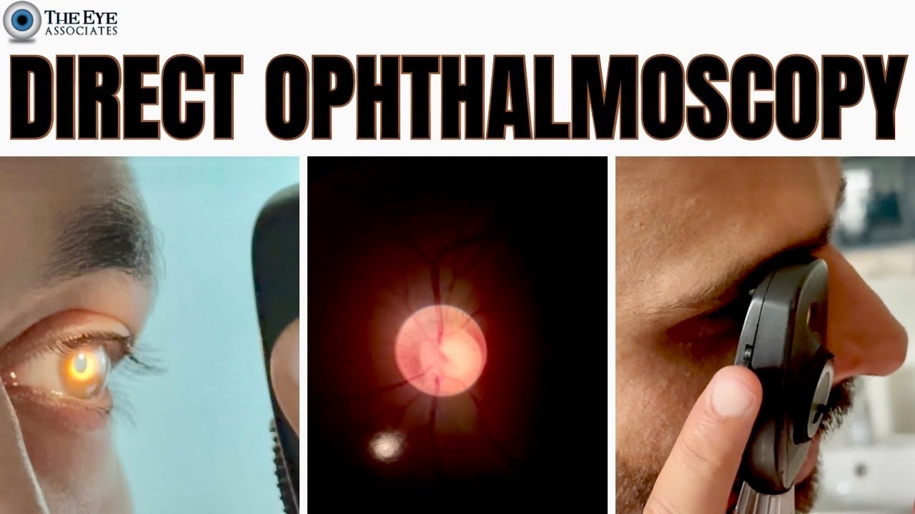 Direct Ophthalmoscopy