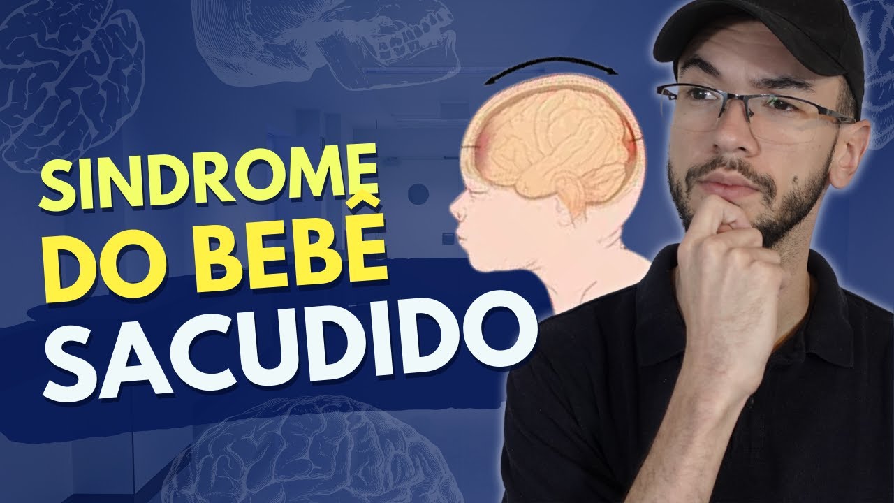 SÍNDROME DO BEBÊ SACUDIDO: O que é, diagnósticos e manejo.